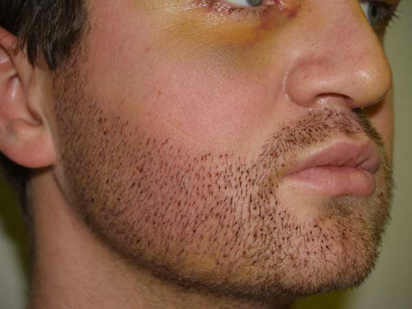 Accélérateur de pousse pour la barbe Nutri Beard 90 Gélules
